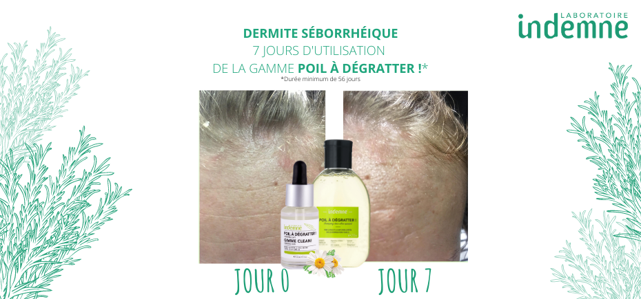 Résultats après 7 jours d'utilisation de la gamme Poil à Dégratter !